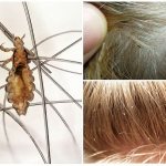 What are lice afraid of?