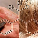 Dust soap for lice - chemical formula DDT