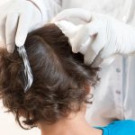 The best remedies for lice and nits