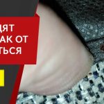Bed bugs and their photos and how to get rid of them in Yekaterinburg