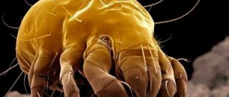 Dust mites in bed - photo of a mite