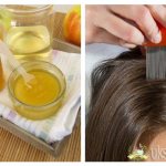Recipes with vinegar against lice and nits