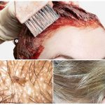 Does hair dye kill lice and nits?