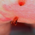 Bedbug bites: photo